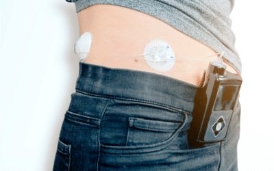 Artificial pancreas: Are we there yet? A summary of the newest automated pump technology