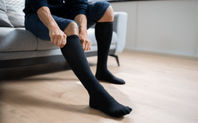 Compression Stockings to Reduce Edema