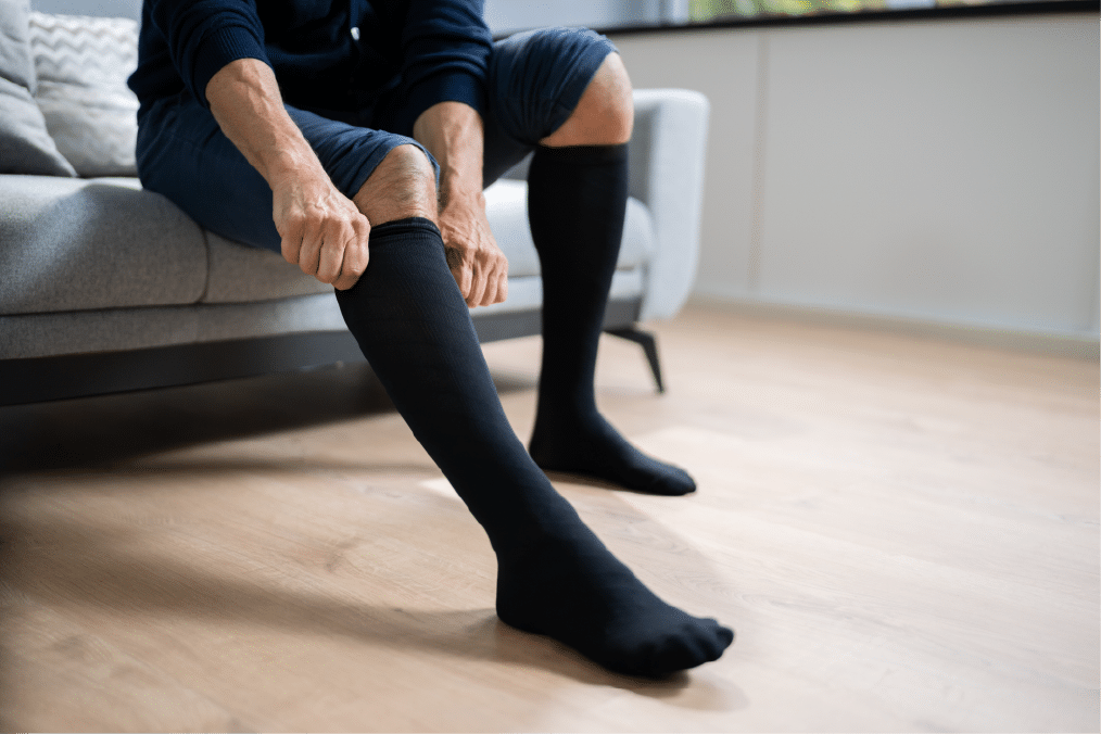 Compression Stockings to Reduce Edema